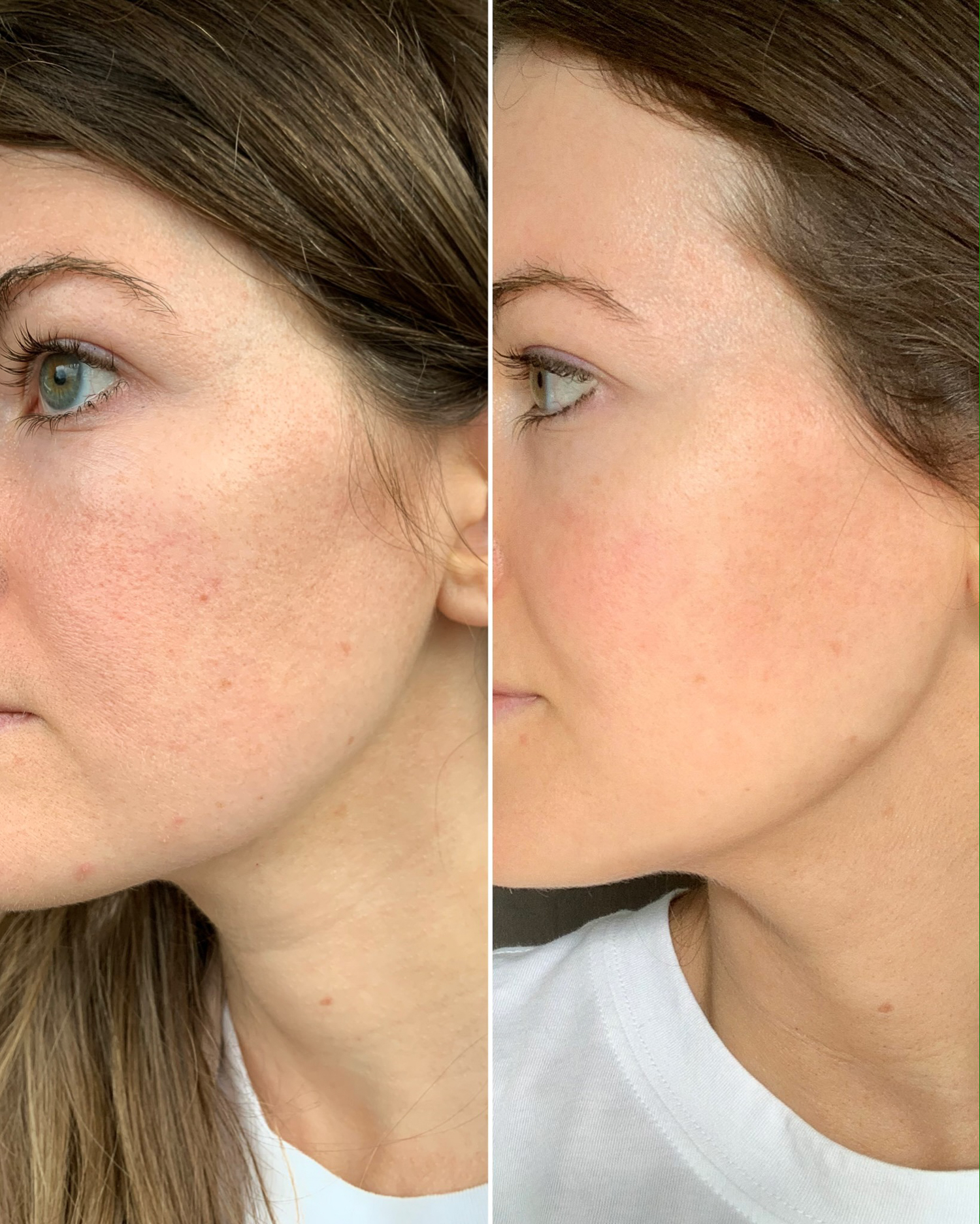 My Experience Using Olay Retinol24 (Before & After Photos!) Southern